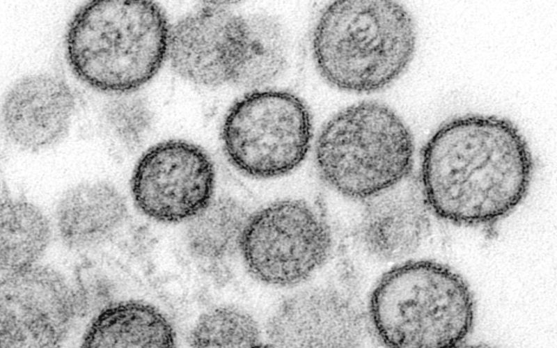 CDC Cynthia Goldsmith, Luanne Elliott Transmission electron micrograph of Sin Nombre virus.T Hantavirus. By CDC Cynthia Goldsmith, Luanne Elliott http phil.cdc.gov PHIL_Images 1137 1137_lores.jpg, Public Domain, https commons.wikimedia.org w index.php?curid=824250